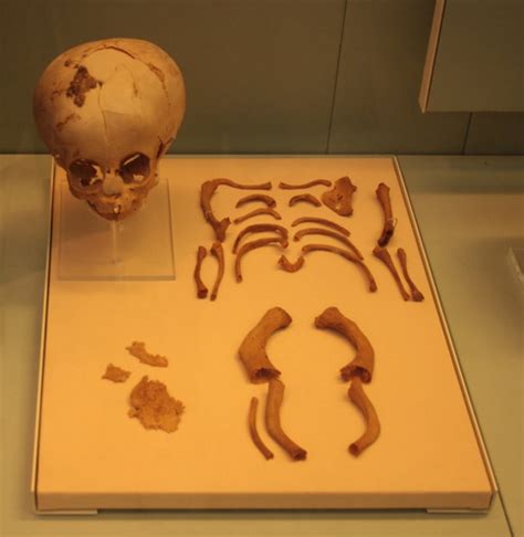 Paleopathology is the study of ancient diseases in human or animal ...