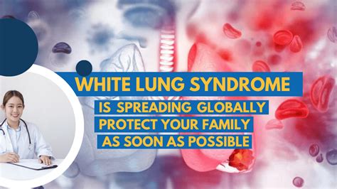 White Lung Syndrome is Spreading Globally - Protect Your Family