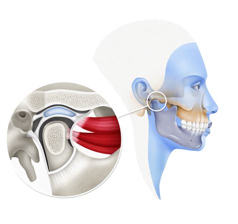 Articulación Temporomandibular - Cirugía Oral y Maxilofacial