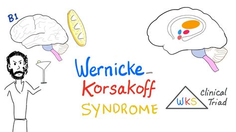 Wernicke-Korsakoff Syndrome (WKS) - Biochemistry - Diet and Nutrition ...