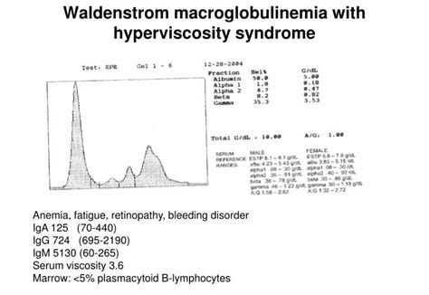 PPT - PLASMA CELL DYSCRASIAS PowerPoint Presentation - ID:710409