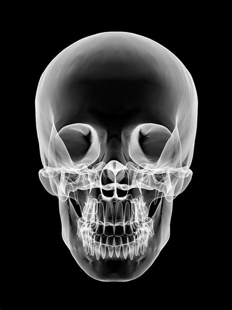 Human Skull, X-ray Artwork by Pasieka | Human skull, Skull, Xray art