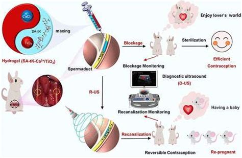 An easily reversed hydrogel male contraceptive