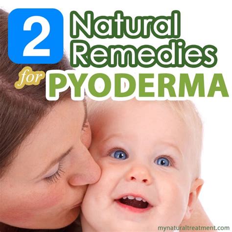 Here you have the most amazing natural remedies for pyoderma with ...