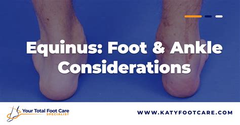 Equinus: Foot & Ankle Considerations | Expert Advice | YTFCS