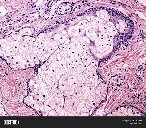 Label The Photomicrograph Of The Sebaceous Gland