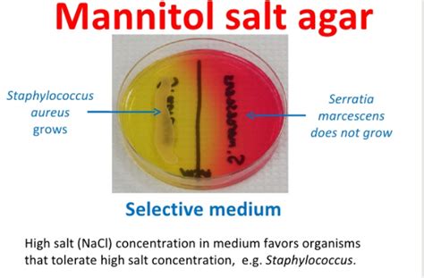 Mannitol salt agar (MSA) Test - SCIENTIST CINDY