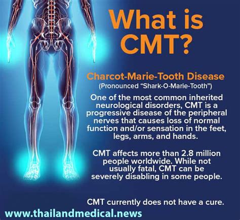 charcot marie tooth disease