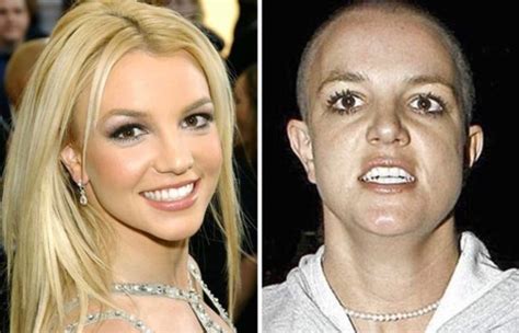 Horrible: 18 Shocking Photos Of Famous Celebrities Before And After Drugs Addiction - GhPage