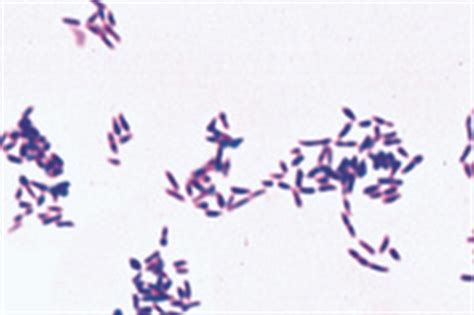 Metachromatic granules or polar bodies (Corynebacterium diphtheriae), smear specially stained ...