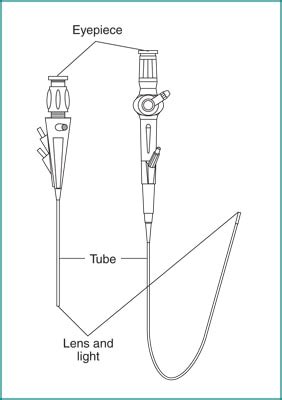 Cystoscopy & Ureteroscopy - NIDDK