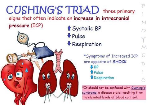 Cushing’s Triad | Anatomie und physiologie, Medizin bilder, Krankenpflege