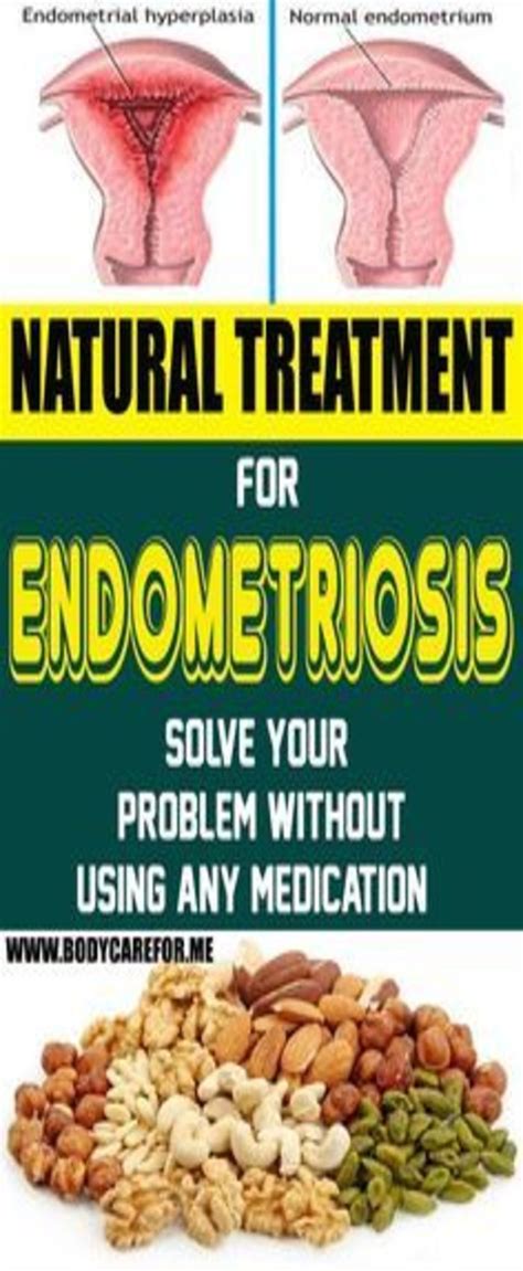 Endometriosis bloating treatment - feetnative