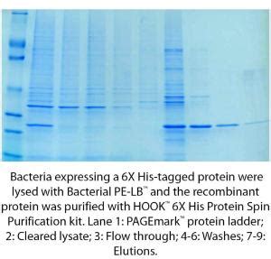 HOOK™ 6X His Protein Purification Kits for Bacteria or Yeast, G-Biosciences | VWR