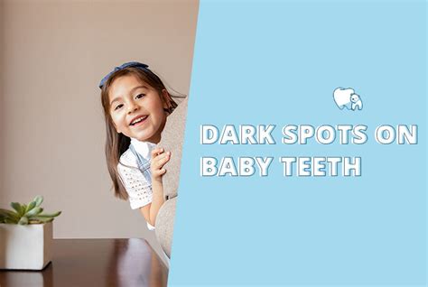 Dark Spots on Baby Teeth [Real Customer Story!]