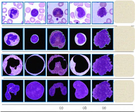 Five types of WBC cell (neutrophil, lymphocyte, eosinophil, monocyte... | Download Scientific ...