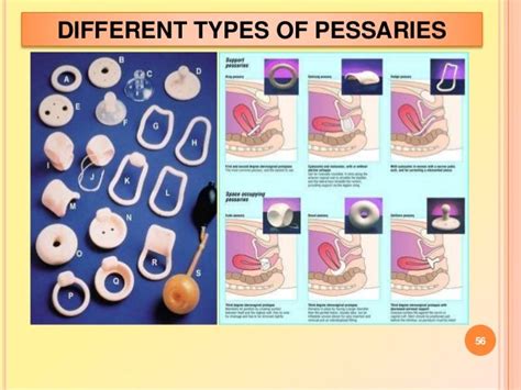 Pelvic Organ Prolapse