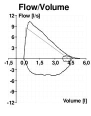 Lung Volumes - Definitions - Measuring - TeachMePhysiology