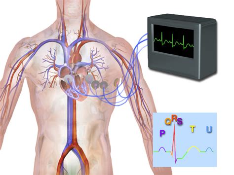 Chief Corner: Continuous Electrocardiographic Monitoring — Inside the ...