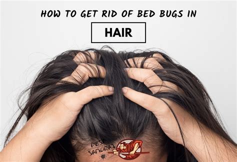 How to Get Rid of Bed Bugs in Hair | Easy Solutions! - Pest Samurai