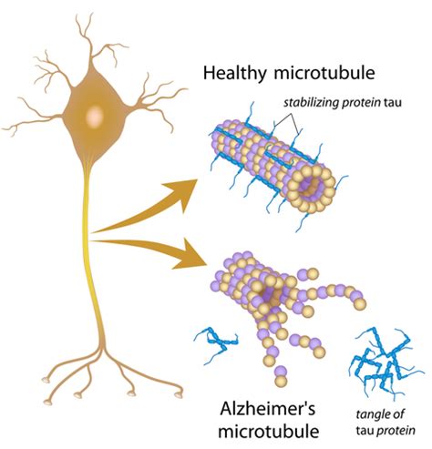 Tau Protein | MyBrainTest