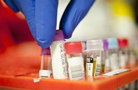 New test to improve blood cancer treatment | Pursuit by The University of Melbourne