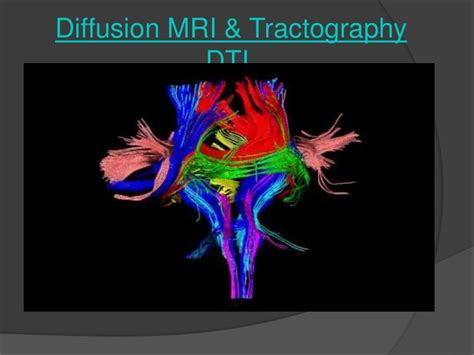 MRI Tractography IMAGING