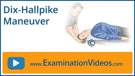 Dix Hallpike Maneuver - YouTube