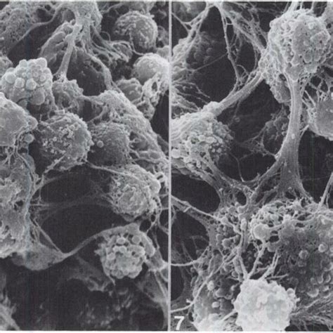 Cumulus oophorus incubated with 0.2 mM MIX for 24 h. Amorphous material ...