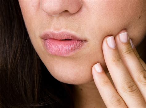What Are Canker Sores And How Do You Get Rid Of Them? | SELF