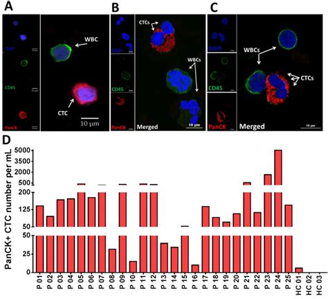 Isolation of circulating tumor cells (CTCs) from non-small-cell lung... | Download Scientific ...