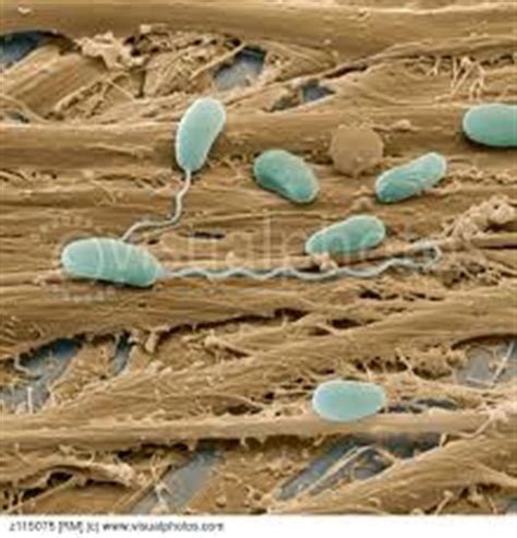 Microsporidia Infection | Ireland| PDF | PPT| Case Reports | Symptoms | Treatment