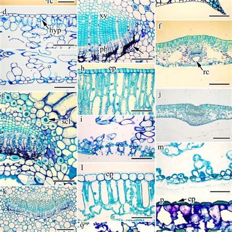 of leaf anatomical features of Taxaceae s. l. (number of samples... | Download Scientific Diagram