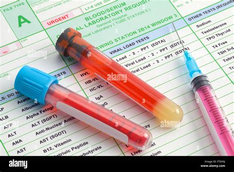 Blood Vials and Syringe with Needle on Top of Lab Results Stock Photo - Alamy