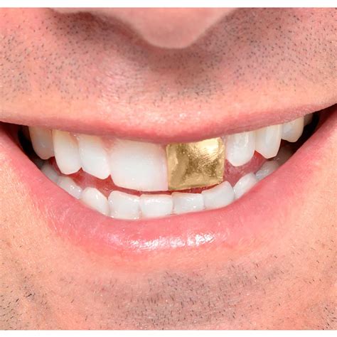 Gold Tooth | Party City Canada