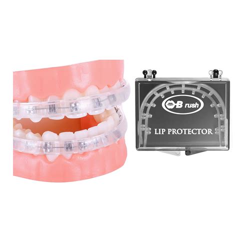 Buy Clip-on Comfort Covers for Braces, Orthodontic Mouth Guard for ...