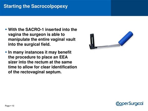 PPT - Sacrocolpopexy – Understanding the Procedure PowerPoint ...