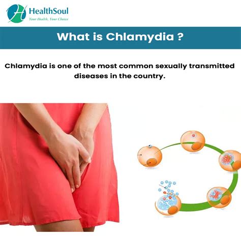 Chlamydia: Symptoms and Treatment – Healthsoul