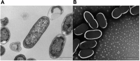 | Transmission electron micrographs of Citrobacter sp. KVM11. Bacterial ...