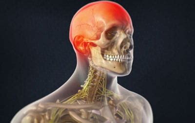 Occipital Neuralgia Treatment NYC | Headaches Doctors Specialists New York