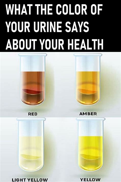 WHAT THE COLOR OF YOUR URINE SAYS ABOUT YOUR HEALTH | Urinal, Health ...