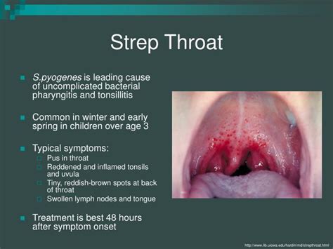 PPT - Streptococcus pyogenes PowerPoint Presentation - ID:291779