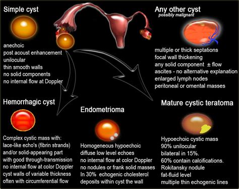 ovary ultrasound images - Αναζήτηση Google | Ovarian cyst, Ovarian cyst ...