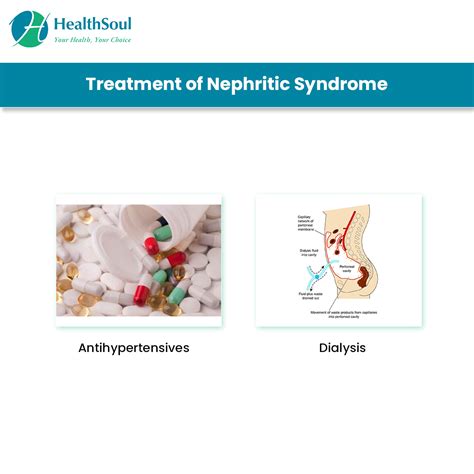 Nephritic Syndrome: Symptoms and Treatment – Healthsoul