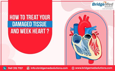 How To Treat Your Damaged Tissue And Week Heart? | by Bridgemed ...