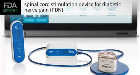 Spinal cord stimulation oK'd for diabetic nerve pain - Medical Buyer