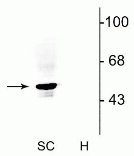 Anti-Glycine Receptor Antibody