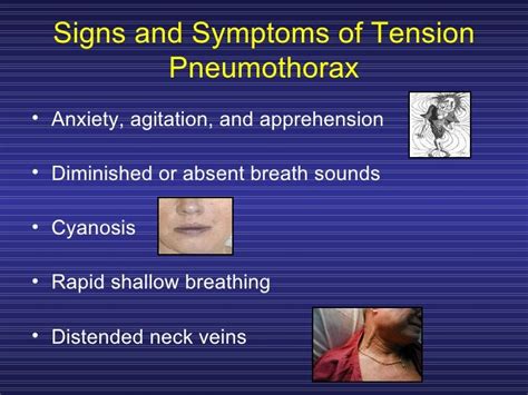 Treating Penetrating Chest Trauma