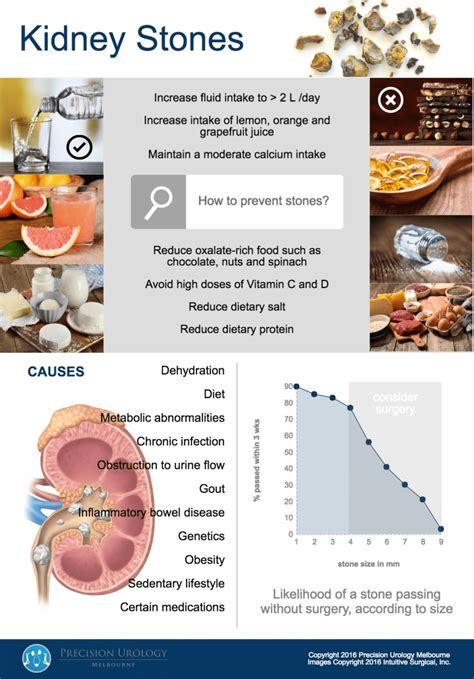 Which Vitamin Causes Kidney Stones - HealthyKidneyClub.com