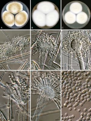 Aspergillus oryzae - microbewiki